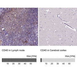 CD40/TNFRSF5 Antibody, Novus Biologicals 0.1mL; Unlabeled:Antibodies, Polyclonal